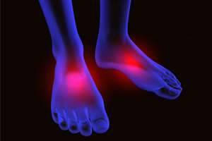 What is Peripheral Neuropathy in Pico Rivera